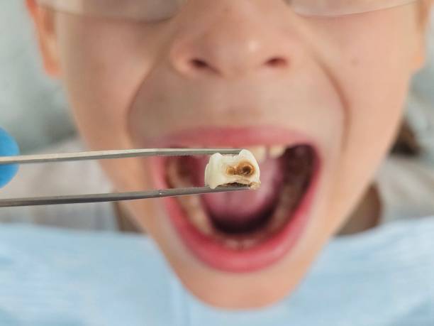 Best Teeth Whitening  in Danville, VA